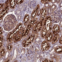 ARSK Antibody, Novus Biologicals 25 &mu;L; Unlabeled:Antibodies, Polyclonal